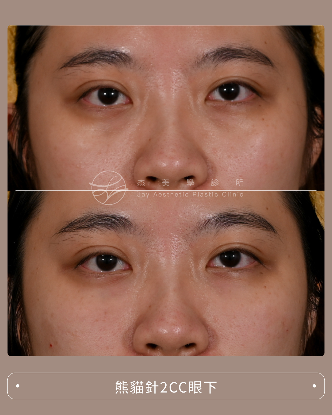 SaveClip.App_526586125_122220859400167167_9185202913936797215_n