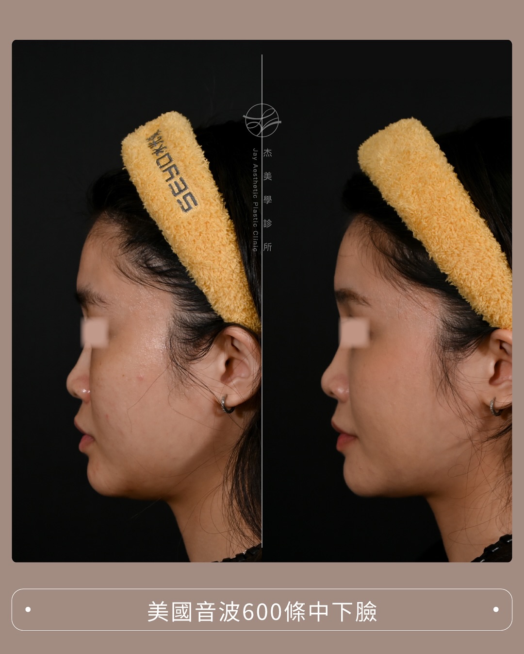 SaveClip.App_562936310_17942598582062937_5431112444766042444_n