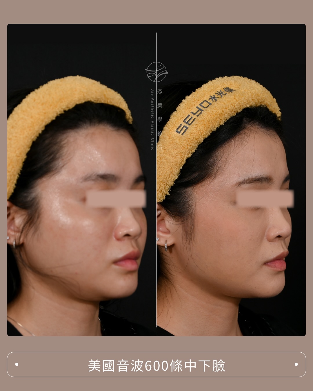 SaveClip.App_563249045_17942598573062937_507748679830723475_n