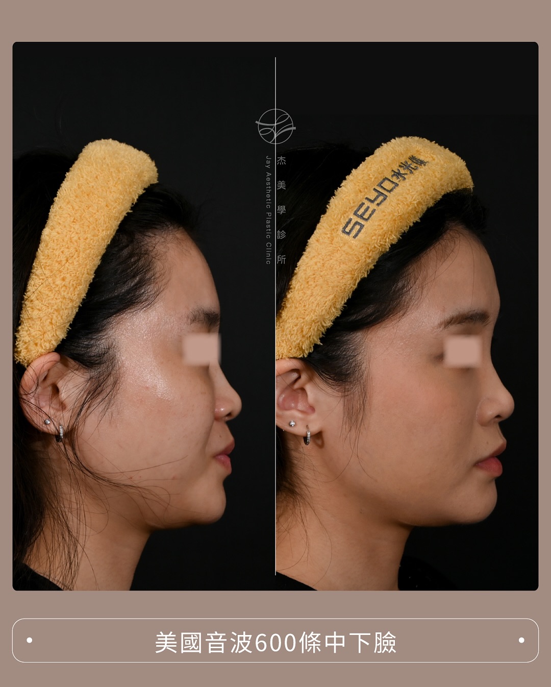 SaveClip.App_563352225_17942598585062937_6171481458737636530_n