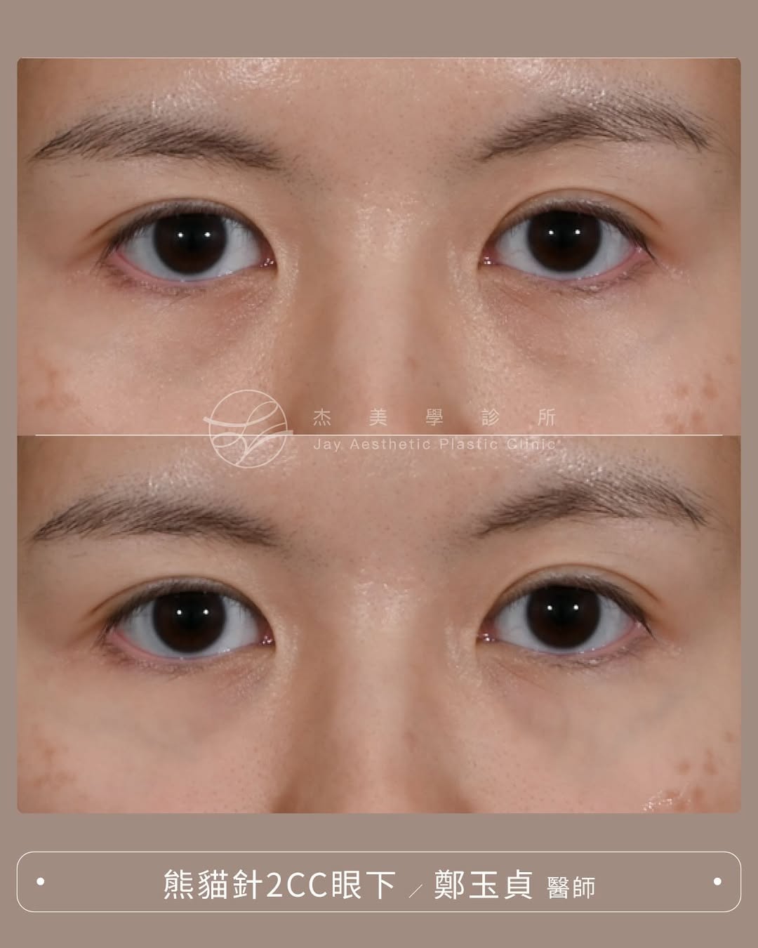 SaveClip.App_563498907_17942716713062937_1763455330423468116_n