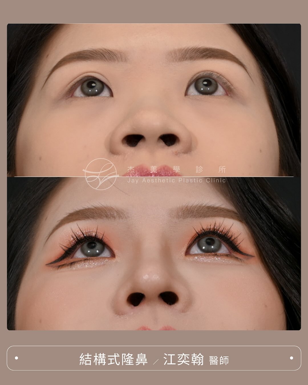 SaveClip.App_564261221_17942939985062937_1203017212451993637_n