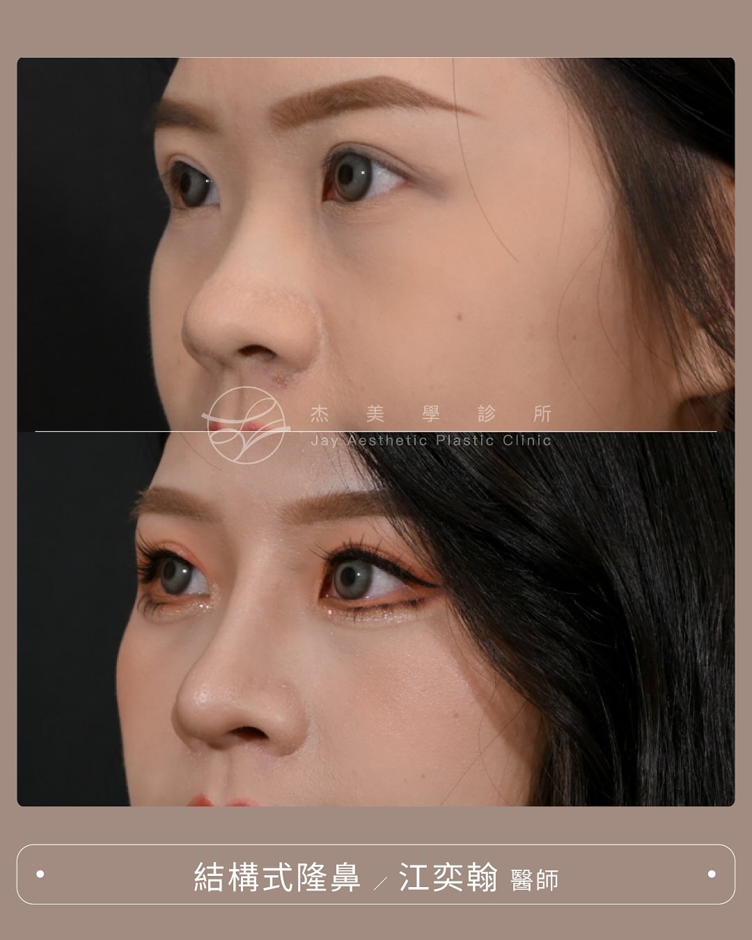 SaveClip.App_565035602_17942939994062937_5493472153348926318_n