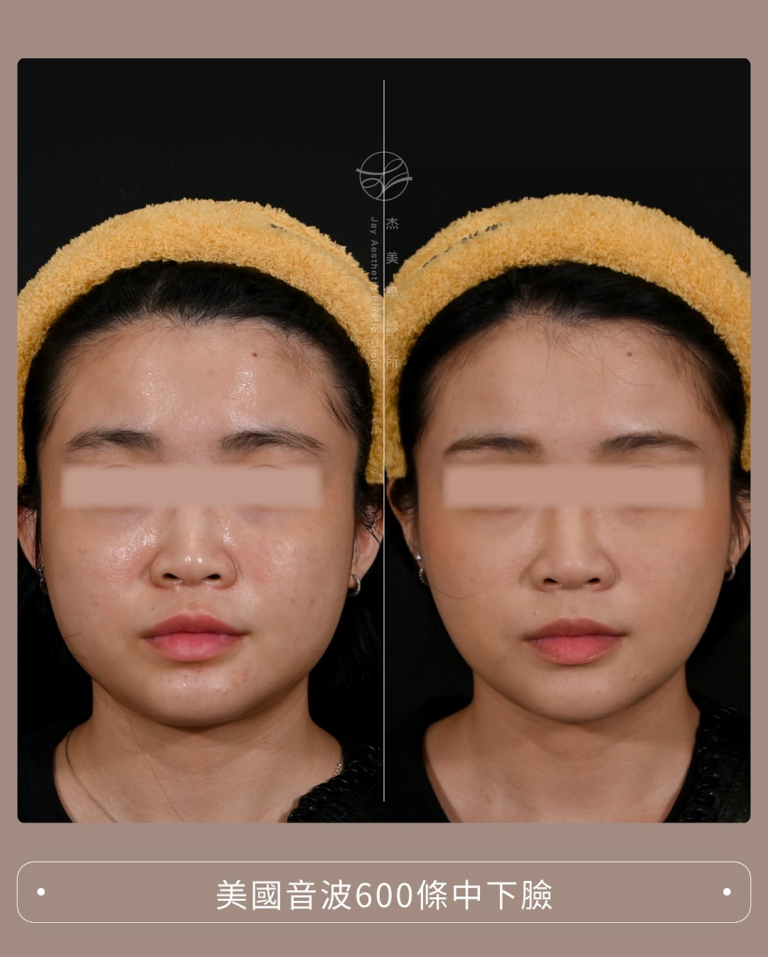 SaveClip.App_565587555_17942598549062937_3166404818773242518_n