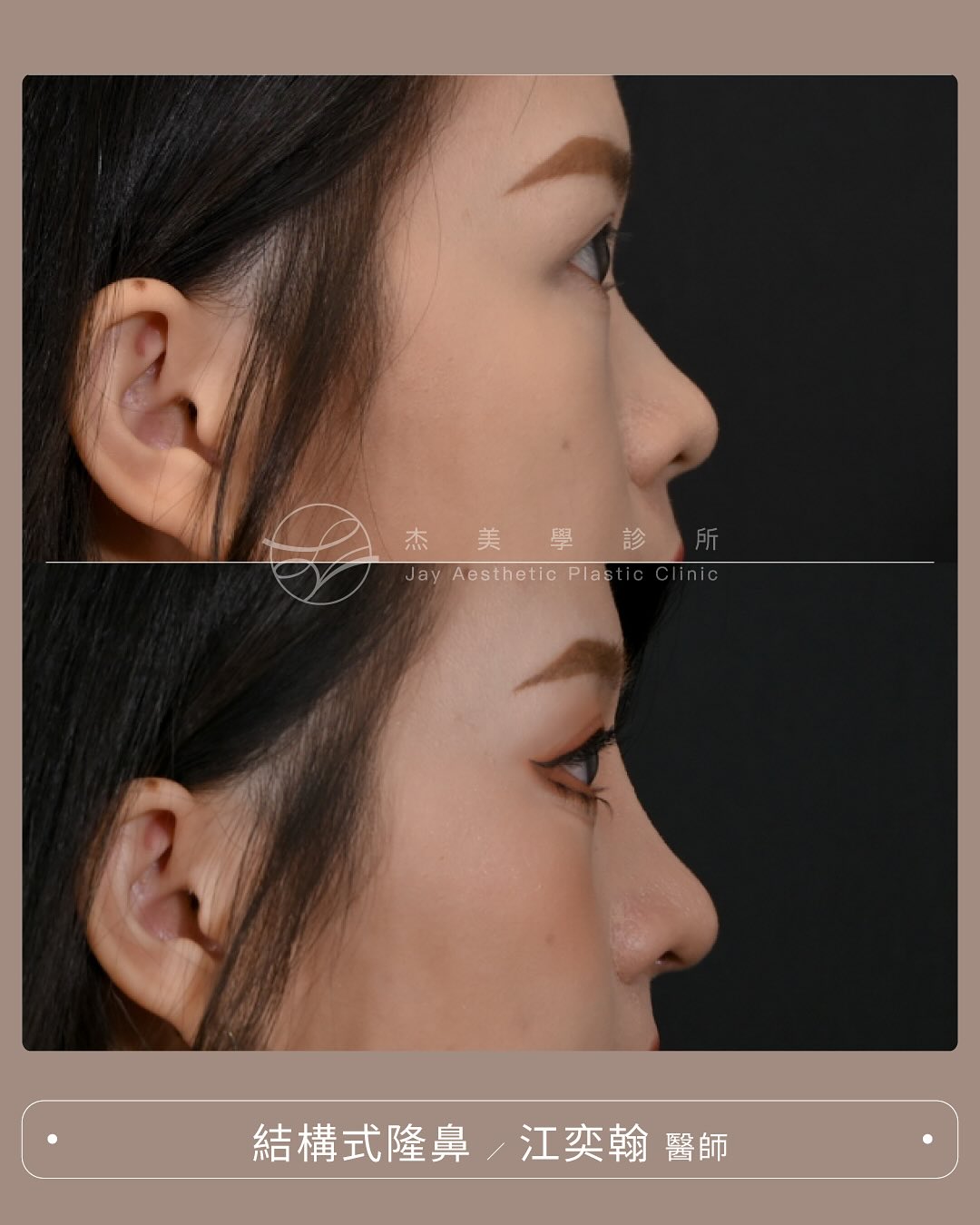 SaveClip.App_568736508_17943558786062937_7000963556116230235_n