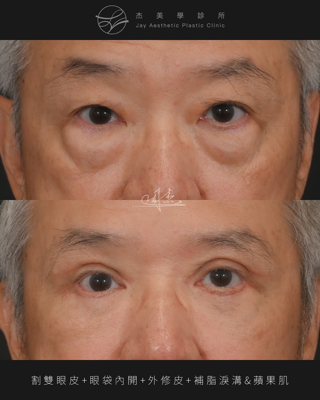 SaveClip.App_570468837_18348973333160158_9026473200657908903_n