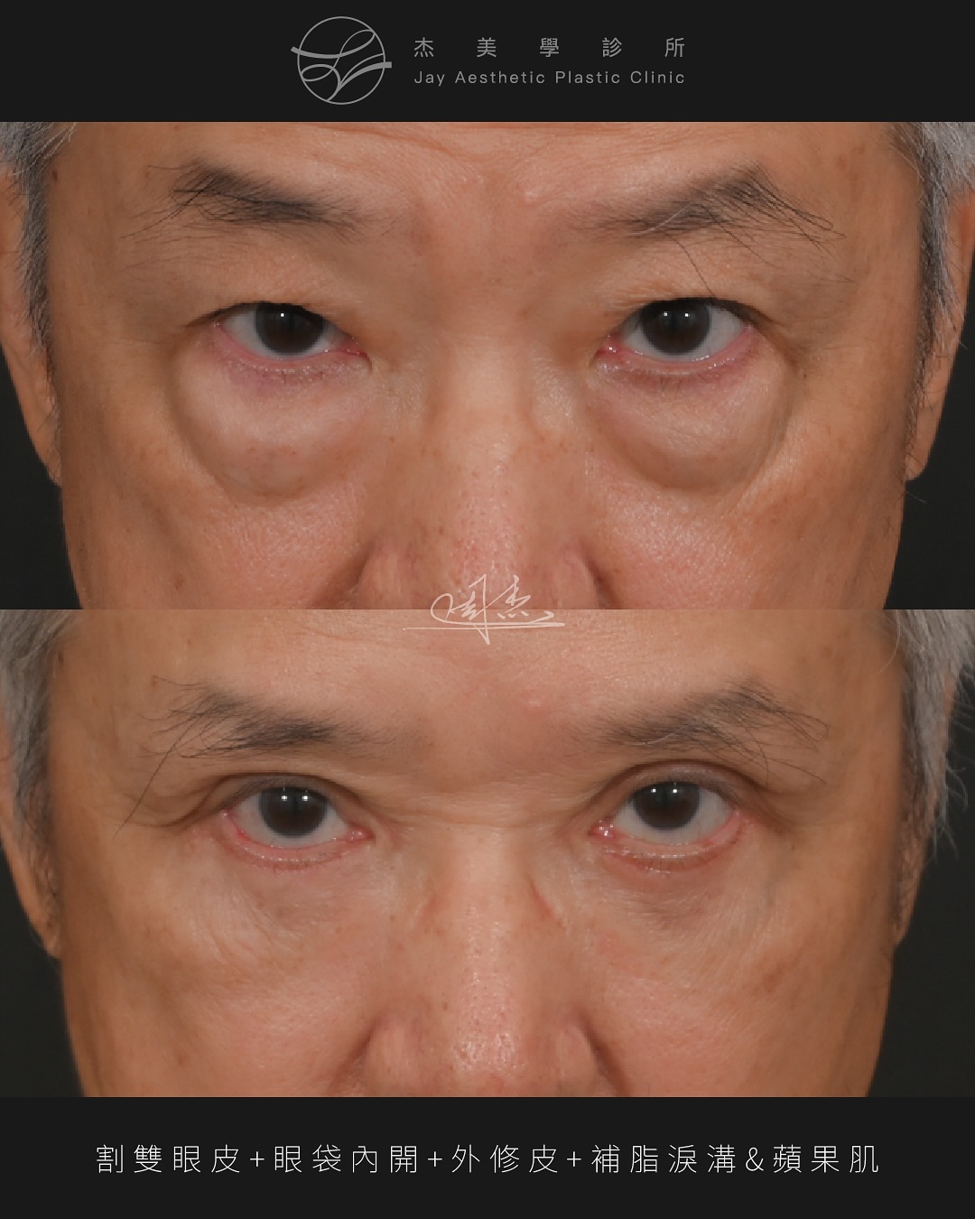 SaveClip.App_570609200_18348973342160158_181491237786966828_n