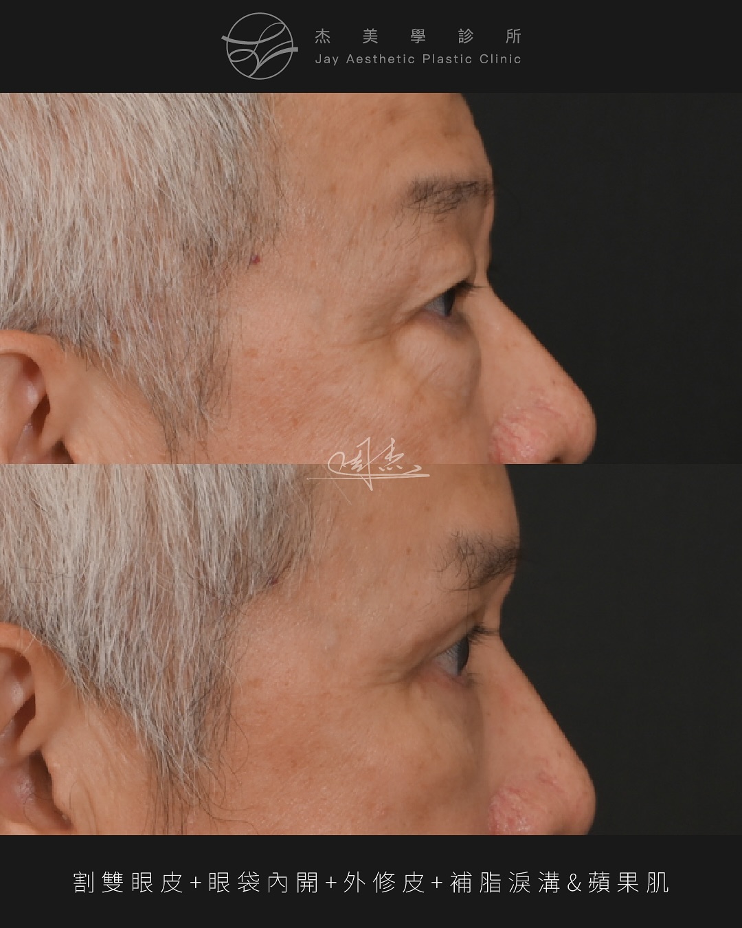 SaveClip.App_571222335_18348973360160158_6230295548468610462_n