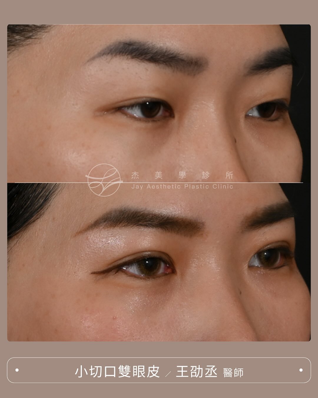 SaveClip.App_571458162_17944473294062937_5706737745813729019_n