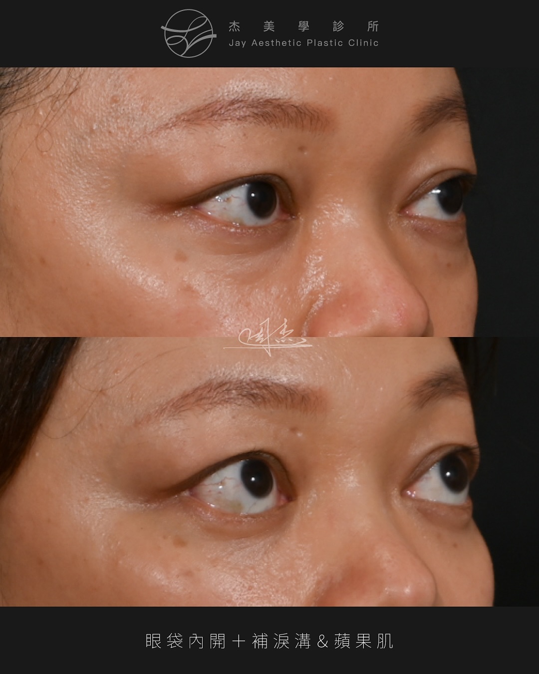 SaveClip.App_572016194_18349489186160158_2719317551397964569_n