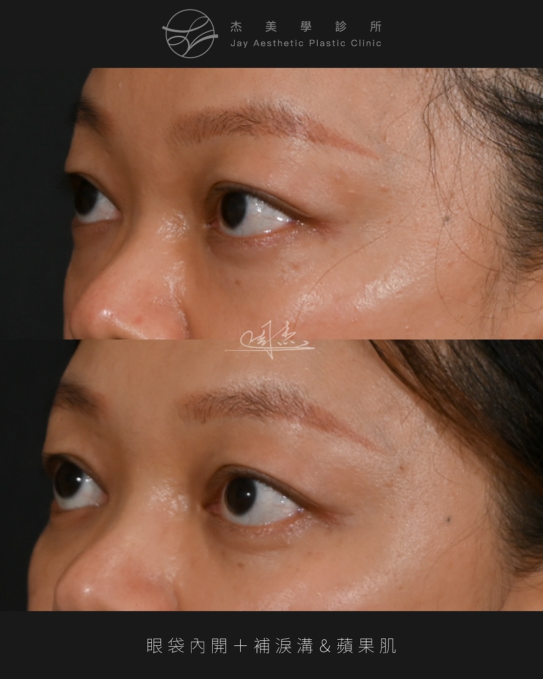 SaveClip.App_572393459_18349489189160158_4642142408119294589_n