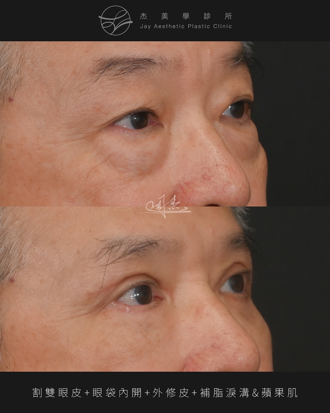 SaveClip.App_573196177_18348973378160158_3896187419908343794_n