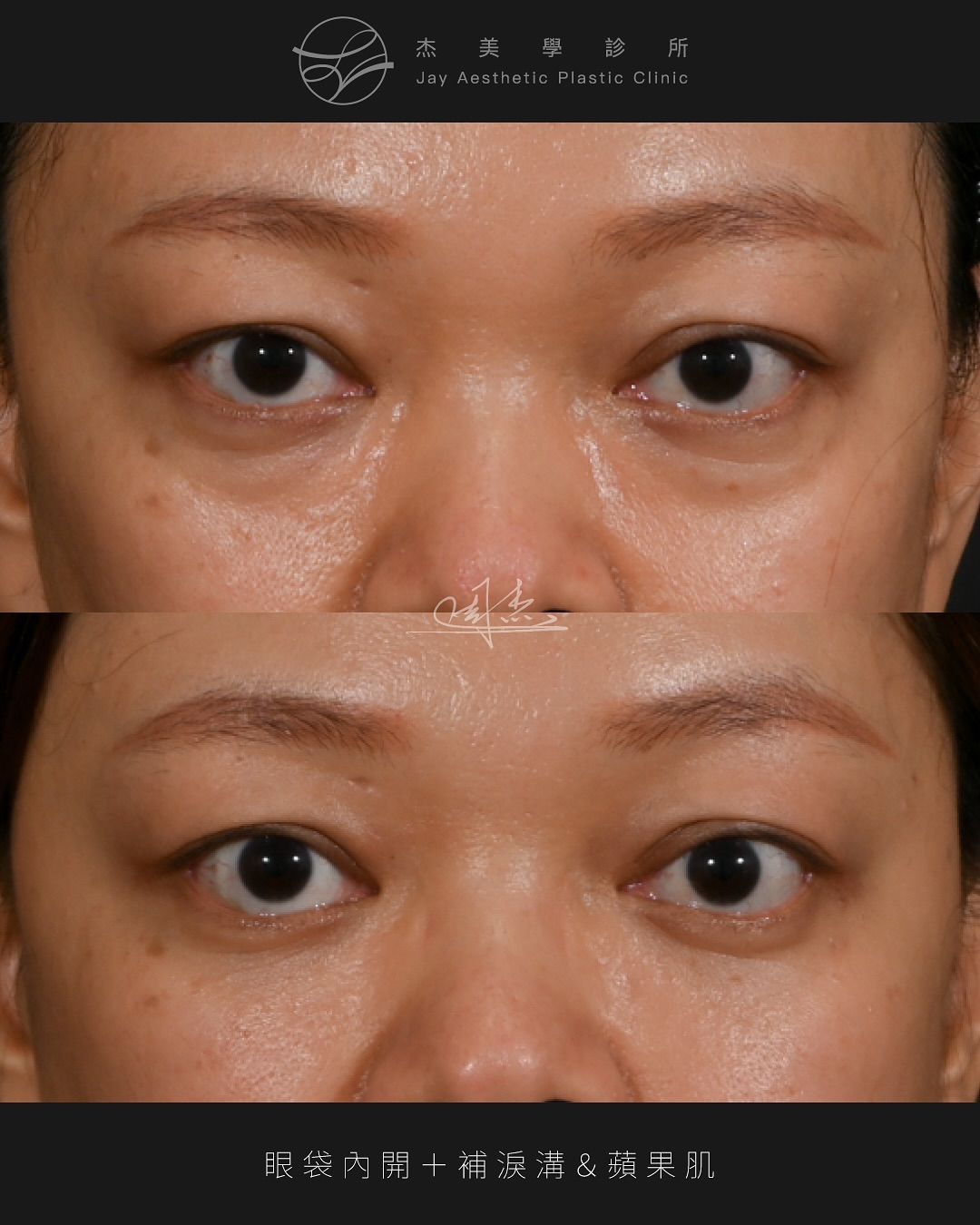 SaveClip.App_573522286_18349489171160158_8313367695162367419_n