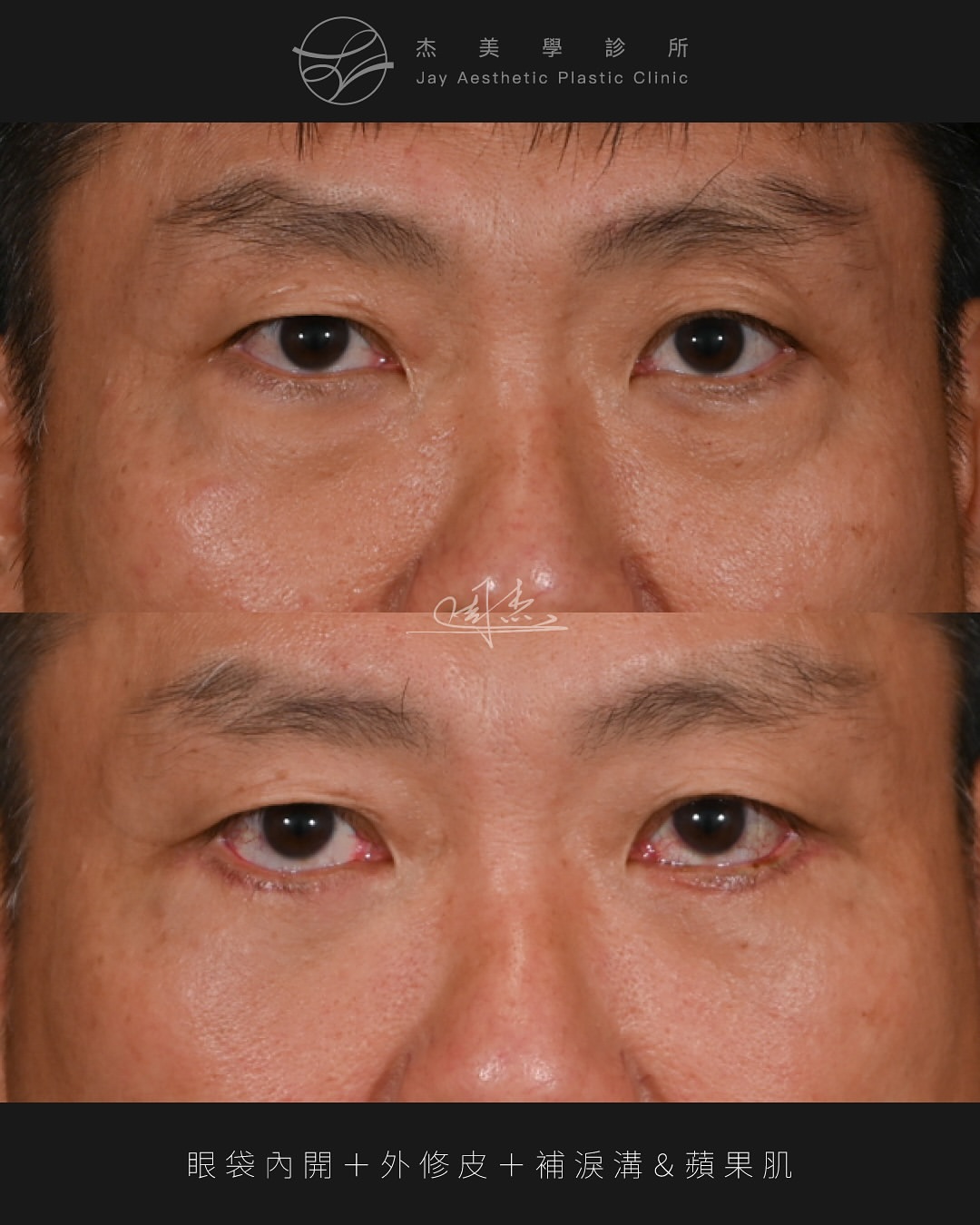 SaveClip.App_574362110_18350232403160158_4223212618629553690_n