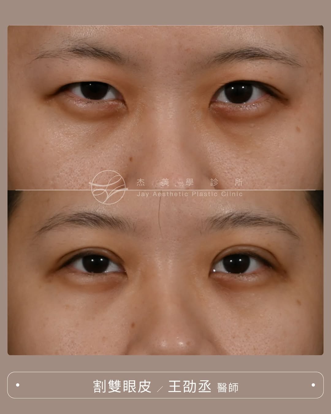 SaveClip.App_575752990_17945506776062937_7237836523911875236_n