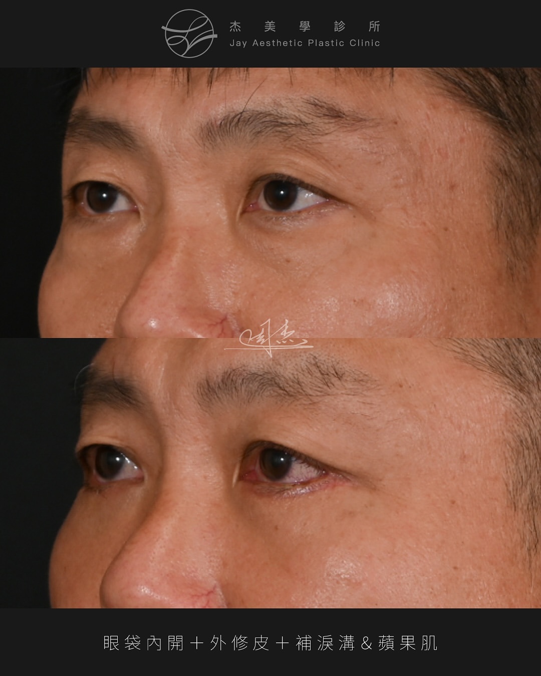 SaveClip.App_576134808_18350232415160158_6750909127776015574_n