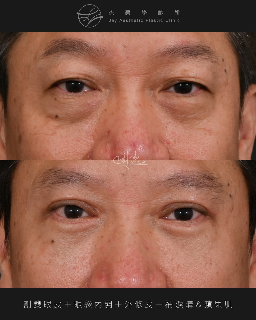 SaveClip.App_580574349_18351541003160158_4856172936621006830_n