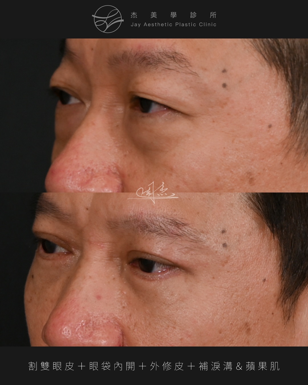 SaveClip.App_581022291_18351541000160158_8731289682427576918_n