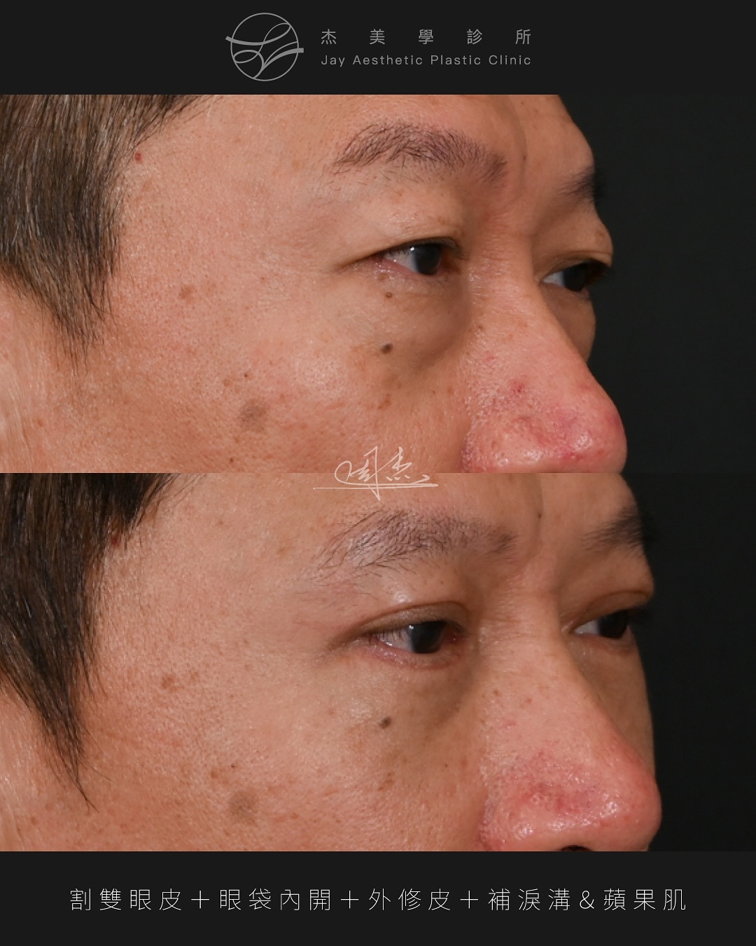 SaveClip.App_581132092_18351541012160158_5167450553135460611_n