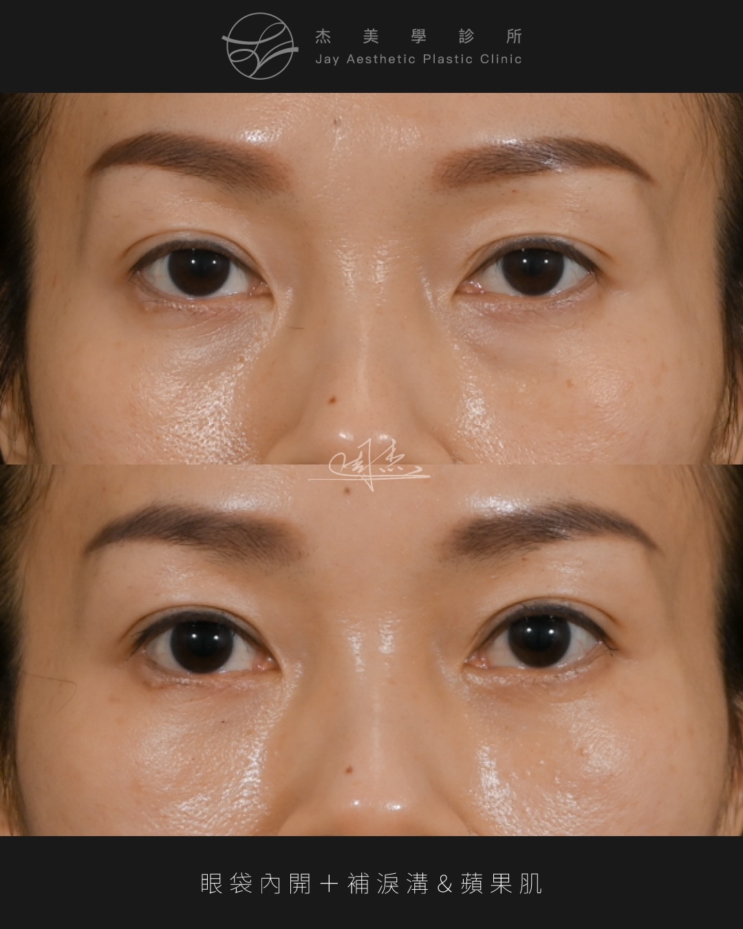 SaveClip.App_584111838_18352768567160158_436104050549832732_n