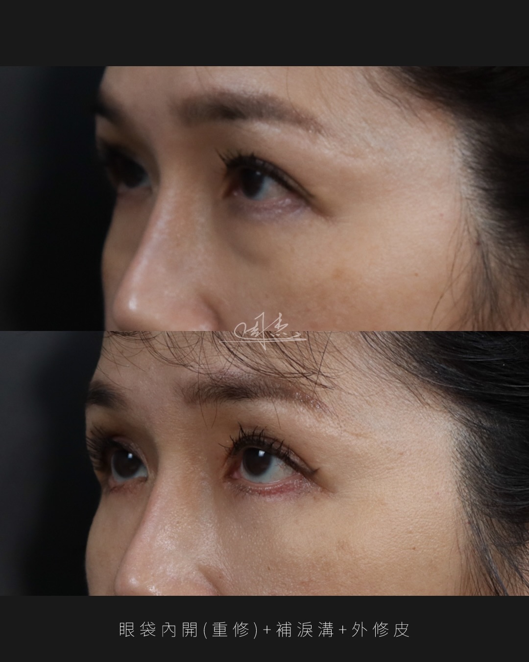 SaveClip.App_587012581_18353060839160158_4591814307296589358_n