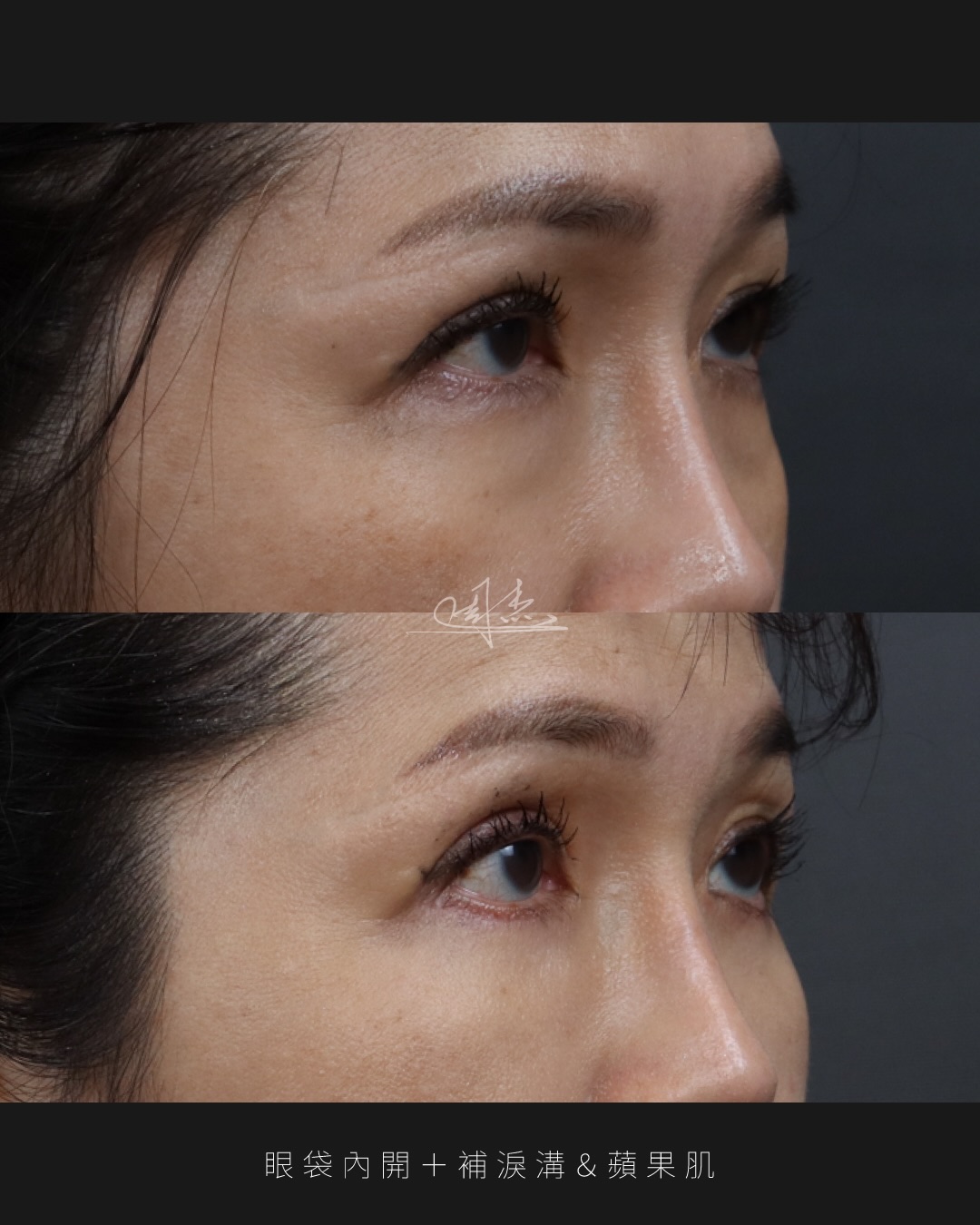 SaveClip.App_587014108_18353060848160158_6309862539462894473_n