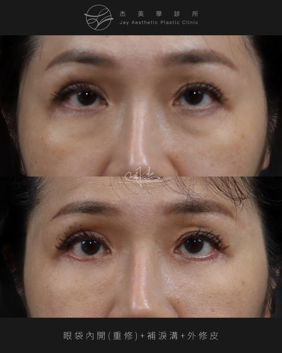 SaveClip.App_587118993_18353060830160158_3697365682520382756_n