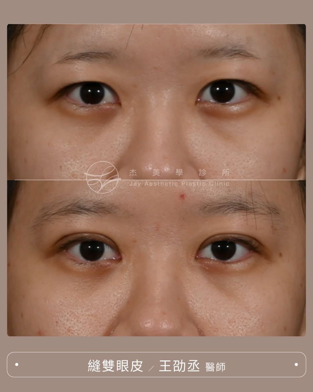 SaveClip.App_587120664_17947129095062937_7030451261700922182_n