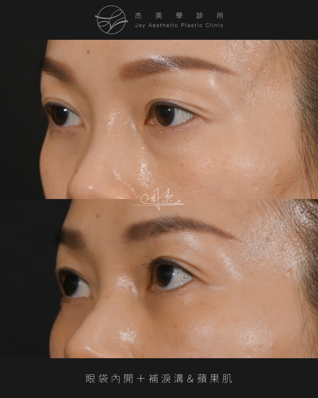 SaveClip.App_587556192_18352768585160158_8330484901643133140_n