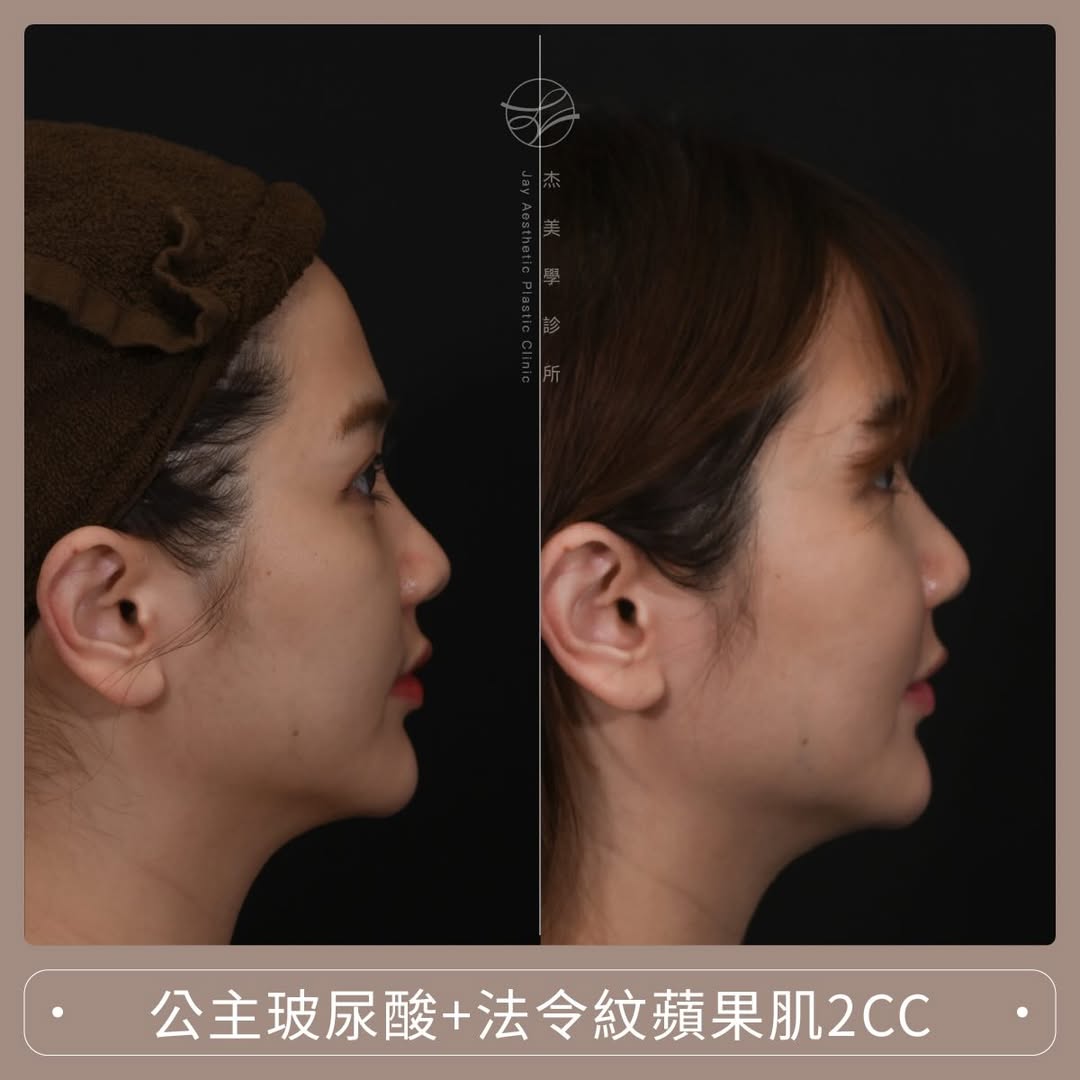 SaveClip.App_587776887_17949340848062937_1147236662123619220_n