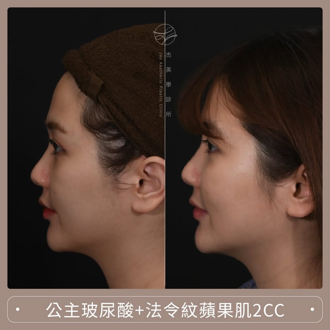 SaveClip.App_587776944_17949340857062937_6037842979920949357_n