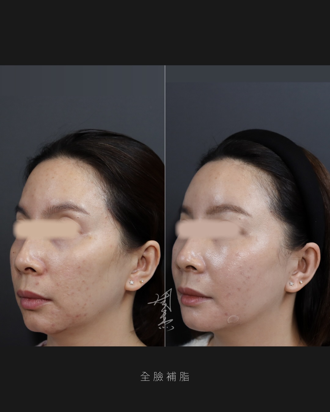 SaveClip.App_589027748_18353650789160158_956239091204922121_n