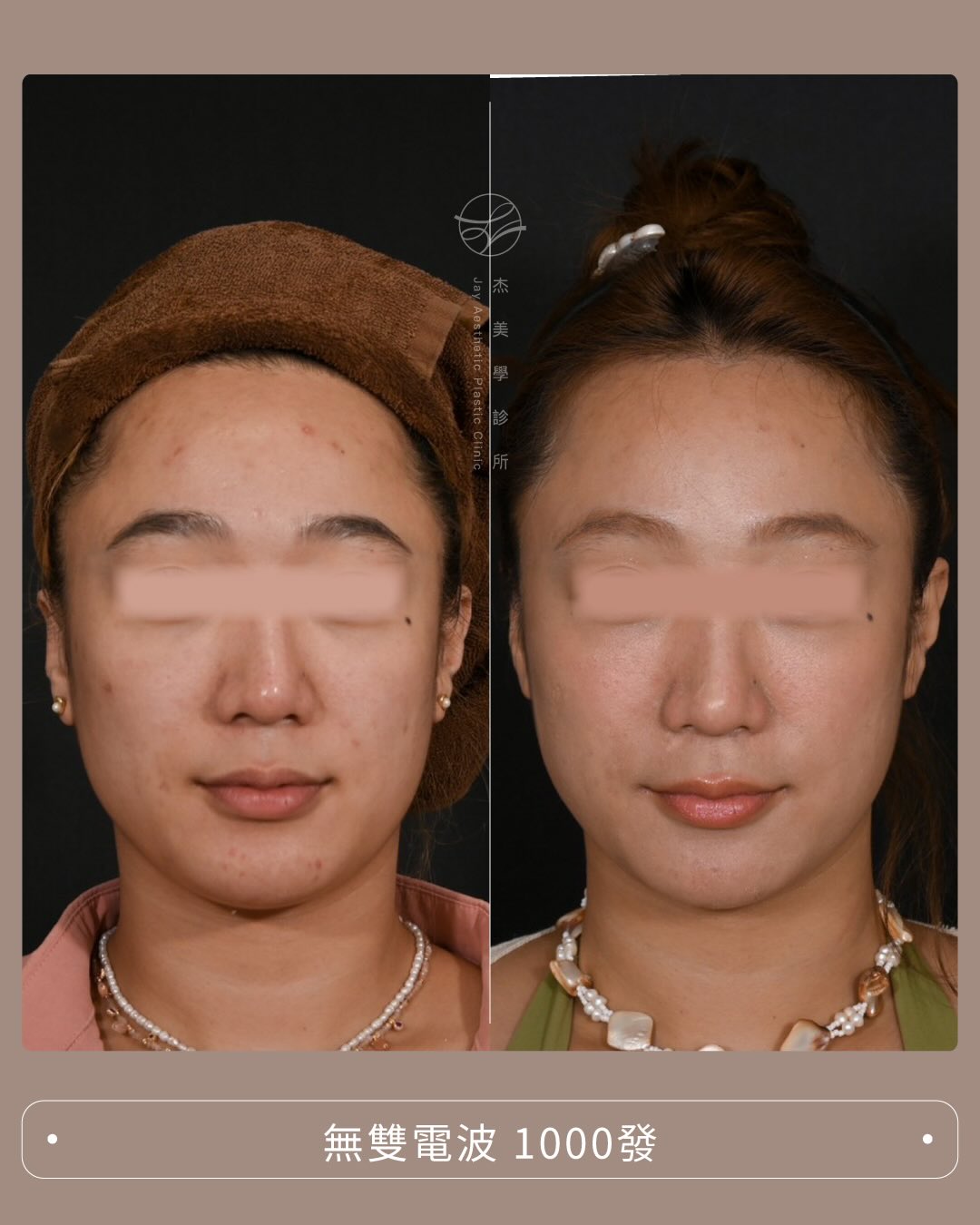 SaveClip.App_589375763_17947221489062937_2295919444956765003_n