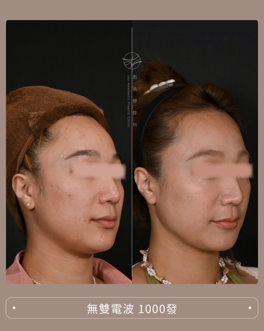 SaveClip.App_589907054_17947221486062937_3326299170672116879_n