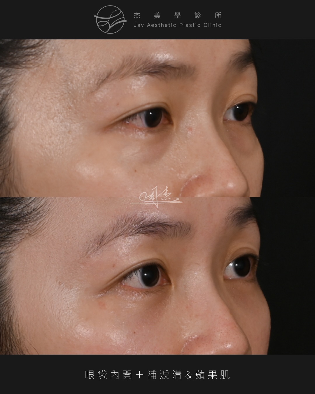 SaveClip.App_590888552_18354127486160158_190257464390518329_n