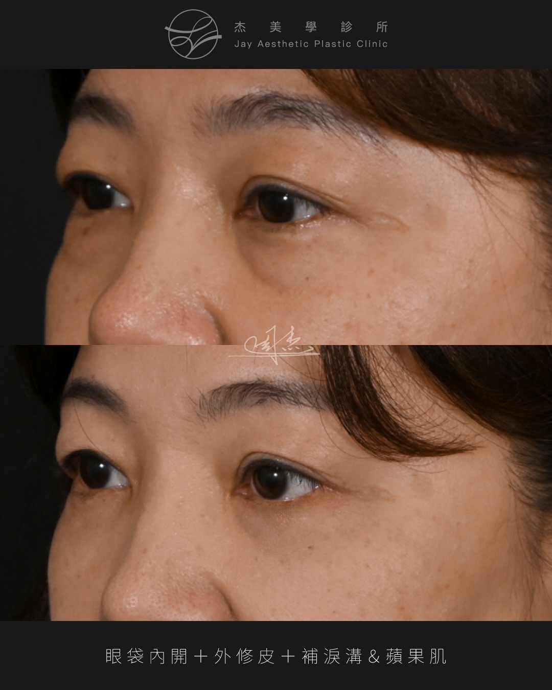 SaveClip.App_590893653_18354127819160158_6993637532873015322_n