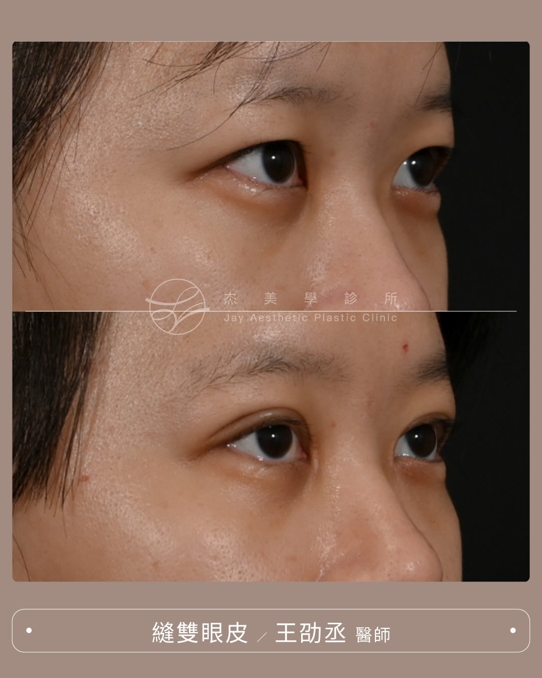 SaveClip.App_591020894_17947946727062937_7783466897570563080_n