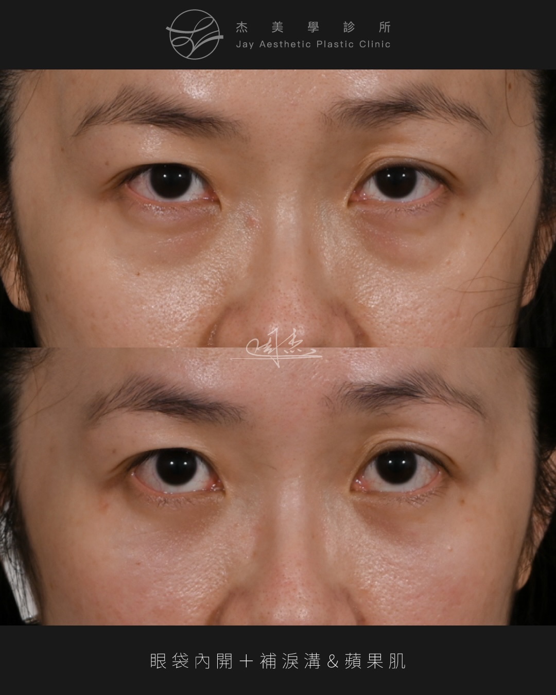 SaveClip.App_591140102_18354127459160158_5759982378175383200_n