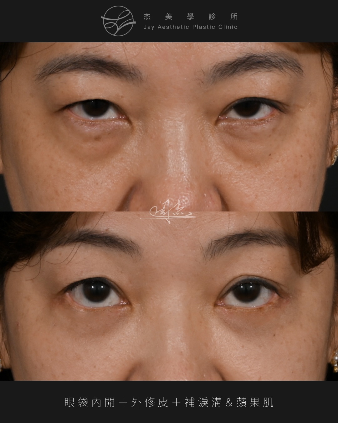 SaveClip.App_591140741_18354127816160158_330100249530104170_n