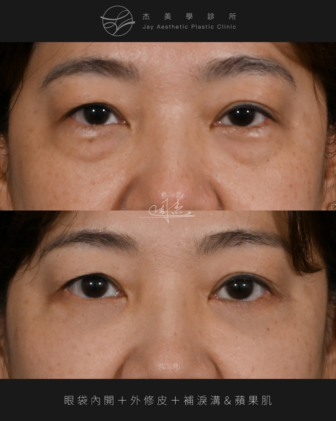 SaveClip.App_591140962_18354127801160158_6197050087493161443_n