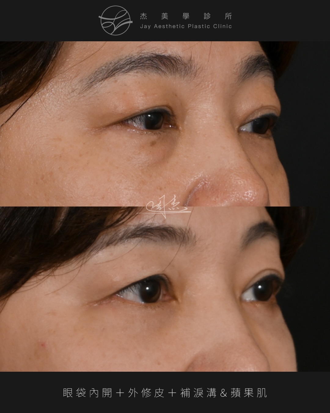 SaveClip.App_591147955_18354127828160158_6147600380078916917_n