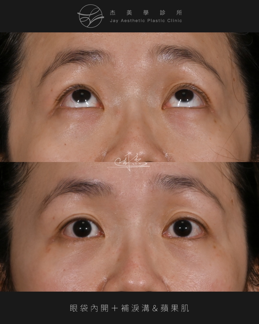 SaveClip.App_591152070_18354127474160158_8208086272613000781_n