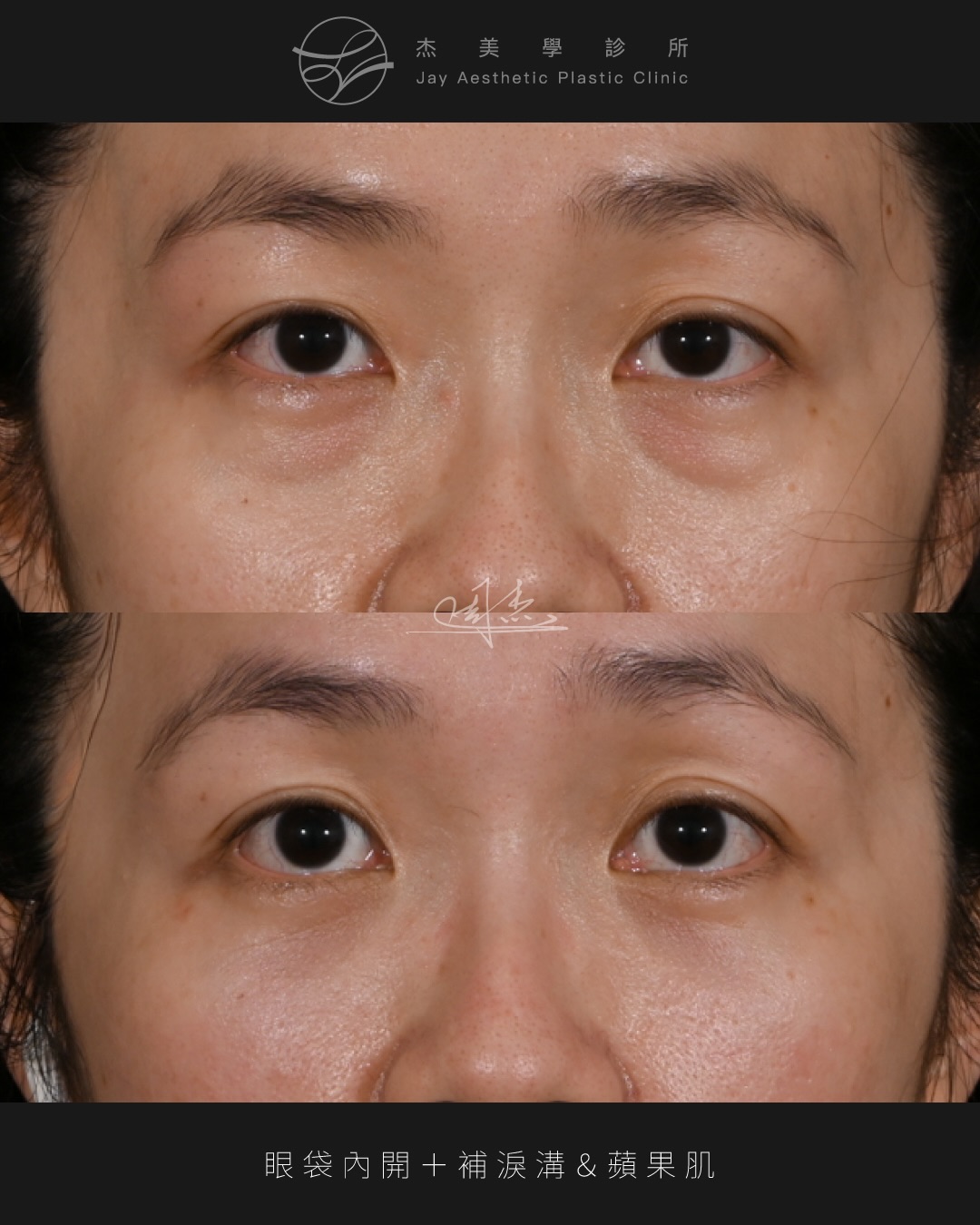 SaveClip.App_591618650_18354127450160158_4312809165831746603_n