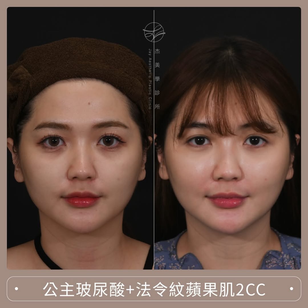 SaveClip.App_598675656_17949223524062937_7190713727643566632_n