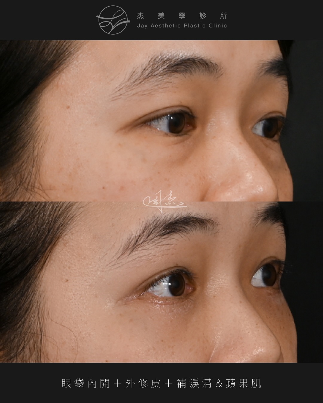 SaveClip.App_601734709_18355402213160158_62804017940886673_n