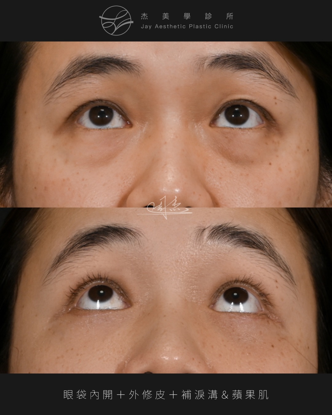 SaveClip.App_602159902_18355402204160158_3132356542307103386_n