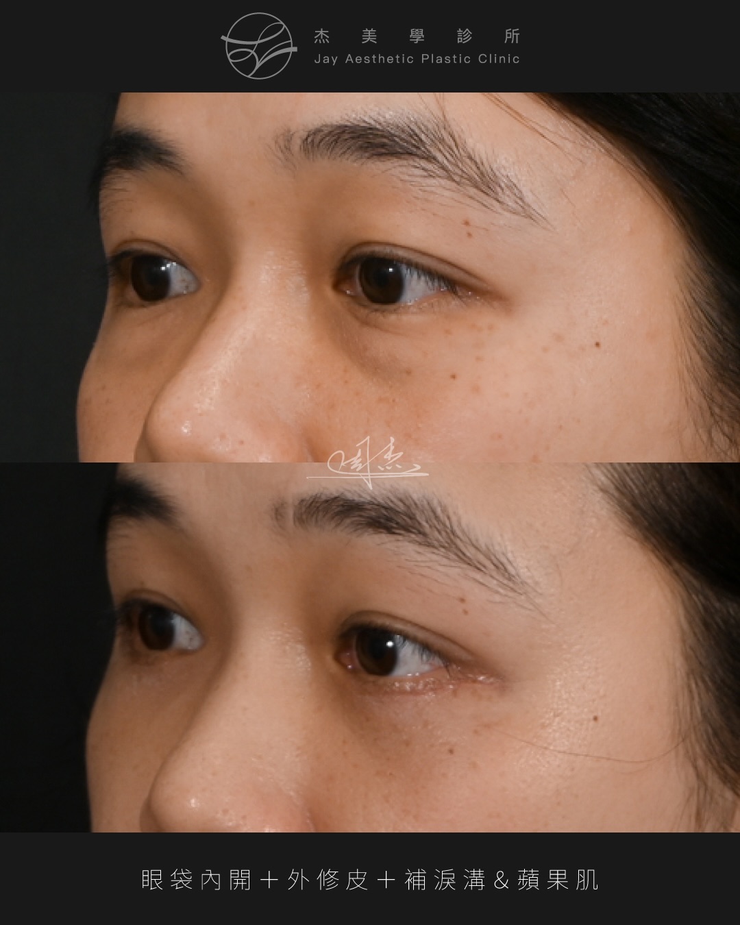 SaveClip.App_603099011_18355402231160158_3389481586536465760_n