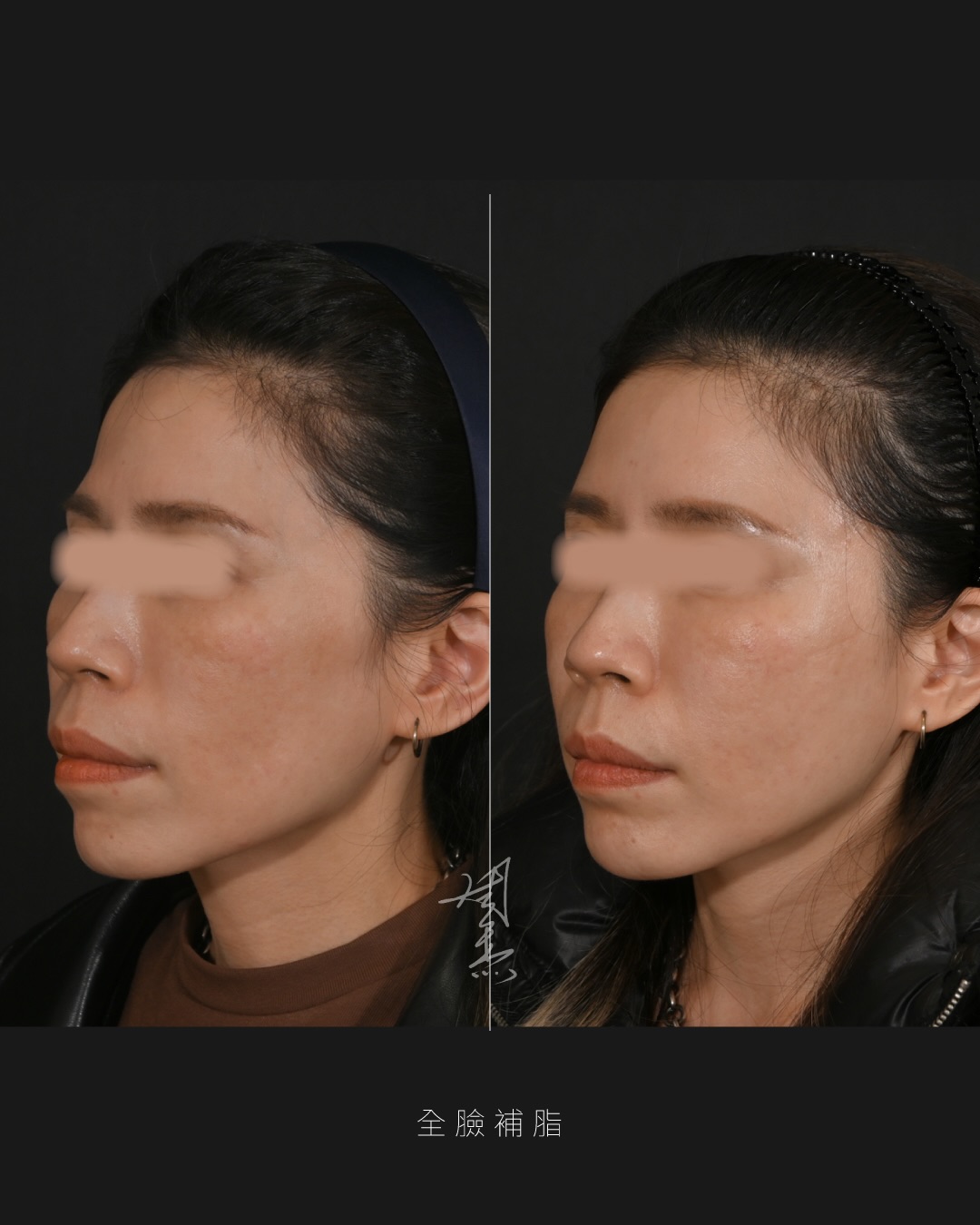 SaveClip.App_607867806_18356504401160158_3636682560986311449_n