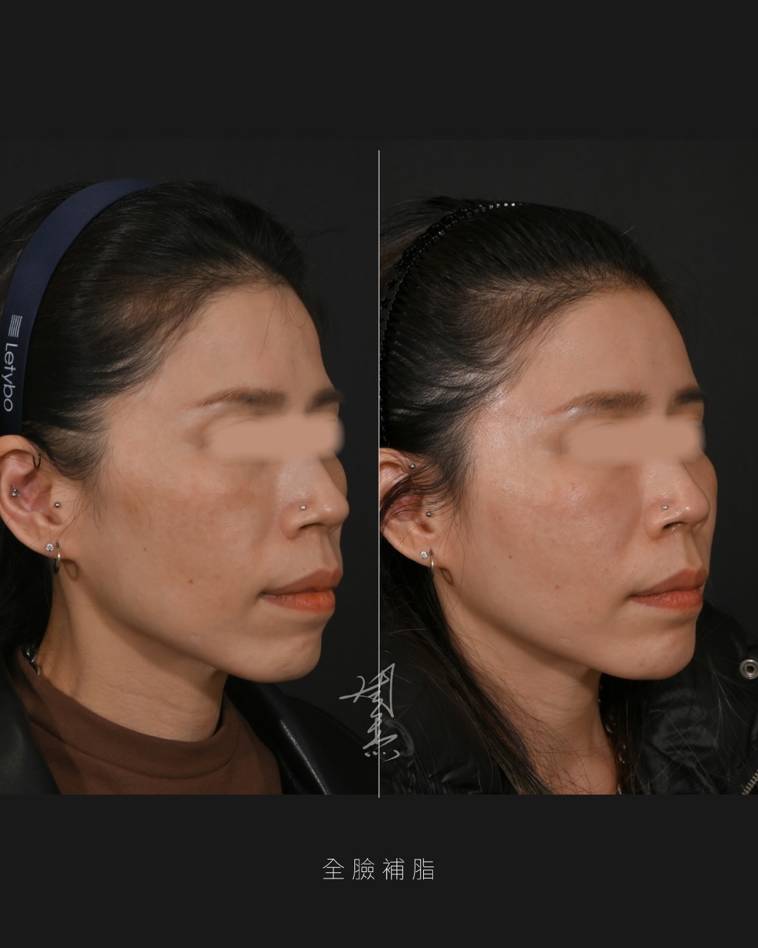 SaveClip.App_607998146_18356504416160158_5751191868363274579_n