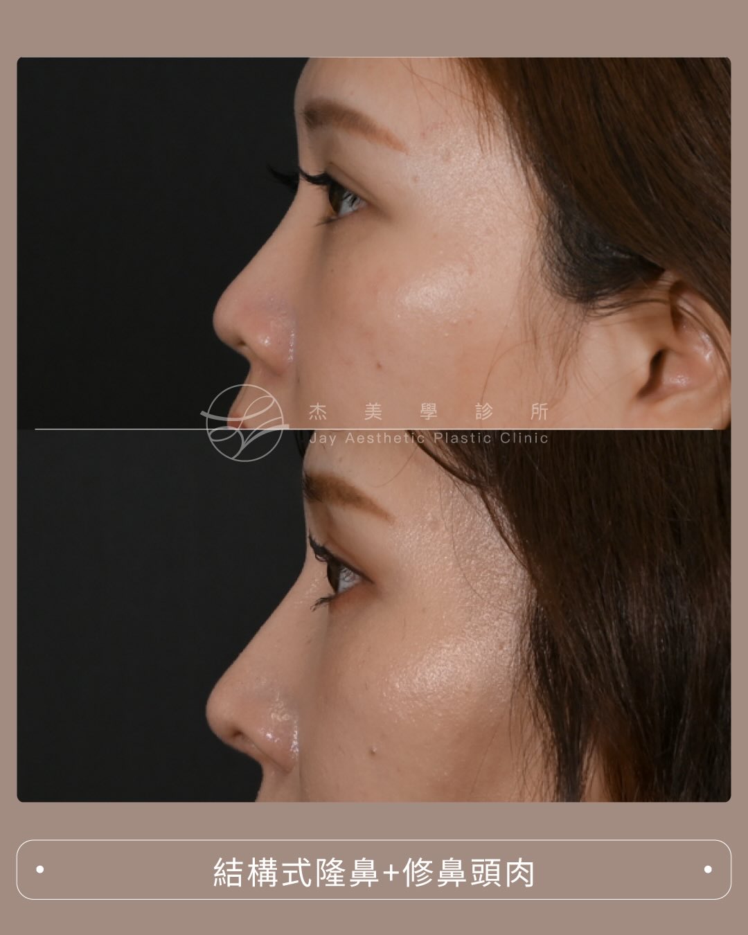 SaveClip.App_609000752_17950799136062937_602100602211330980_n